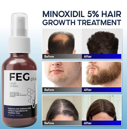 FEG PLUS Hair Growth Spray (سبراي نمو الشعر FEG PLUS)